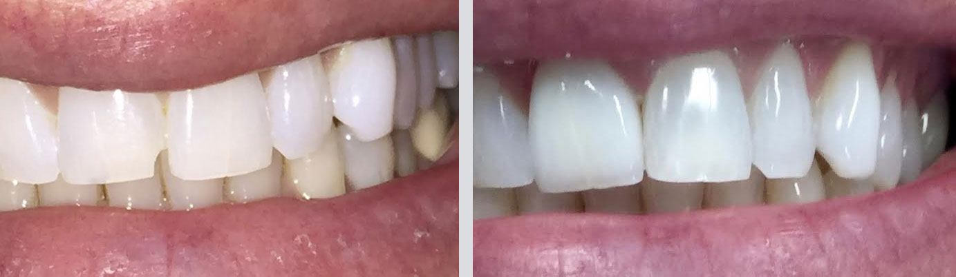 Cosmetic Dentistry