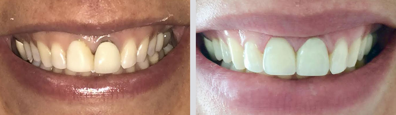 Cosmetic Dentistry