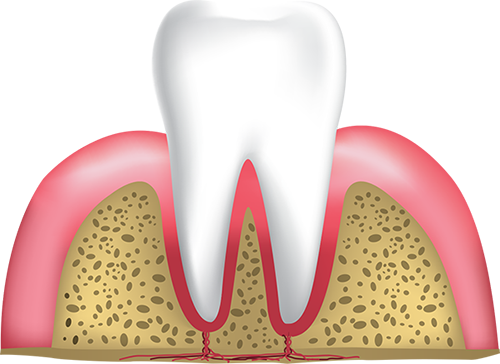 healthy gums and tooth Hyannis, MA