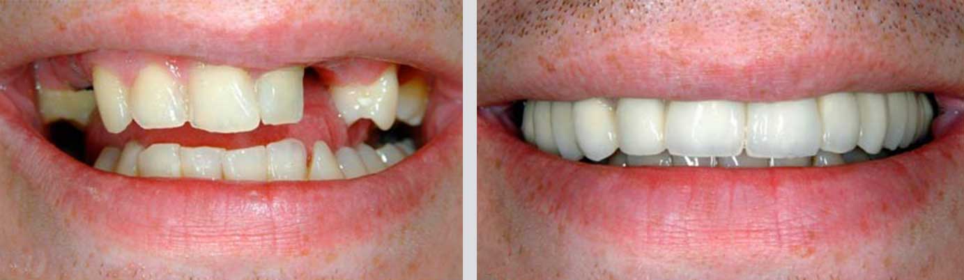 cosmetic dentistry before and after